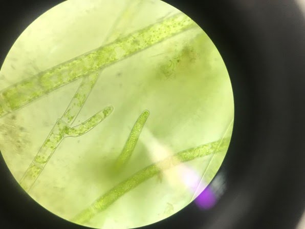 Spirogyra [Image: courtesy of Synthetic Landscape Lab Innsbruck University]